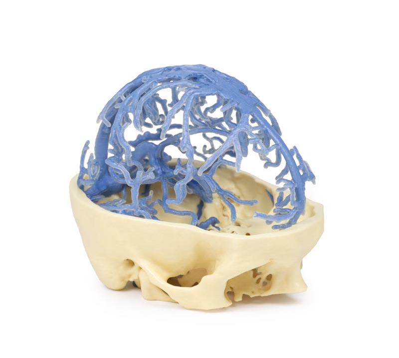 3D Printed Anatomy - Venous Circulation - 3