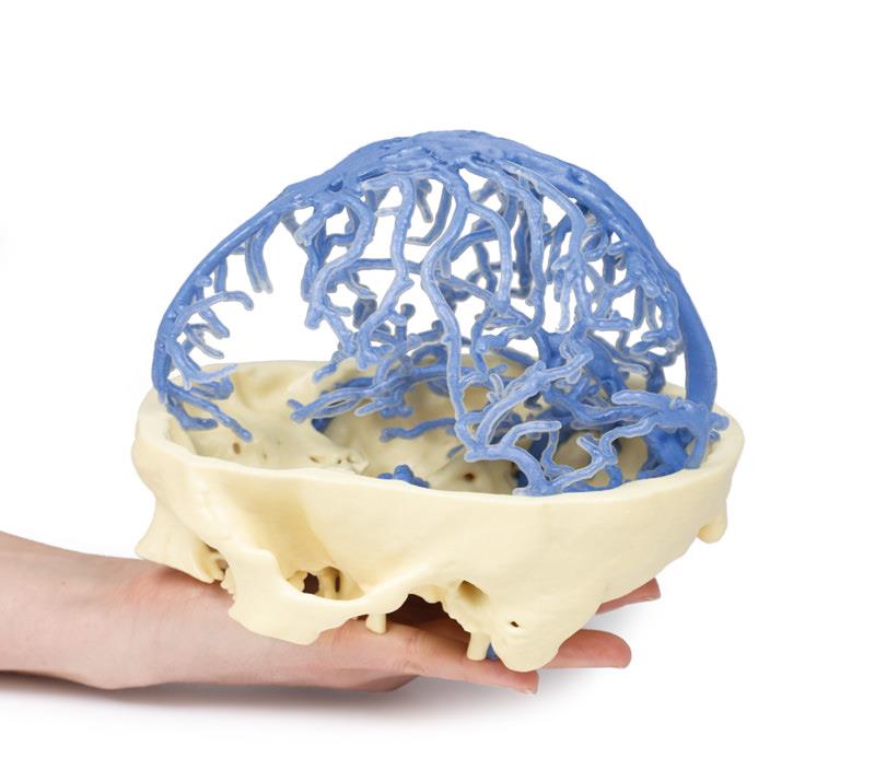3D Printed Anatomy - Venous Circulation - 6