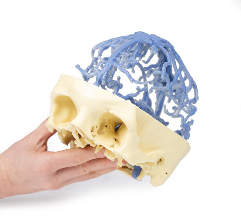 3D Printed Anatomy - Venous Circulation - 7