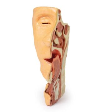 Deep face/Infratemporal fossa