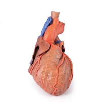 Heart and the distal trachea, carina and primary bronchi