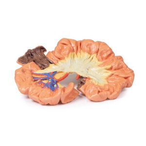 Bowel – Portion of Ileum