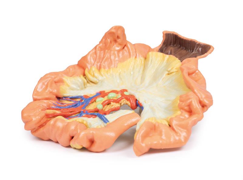 Bowel - Portion of Jejenum - 3