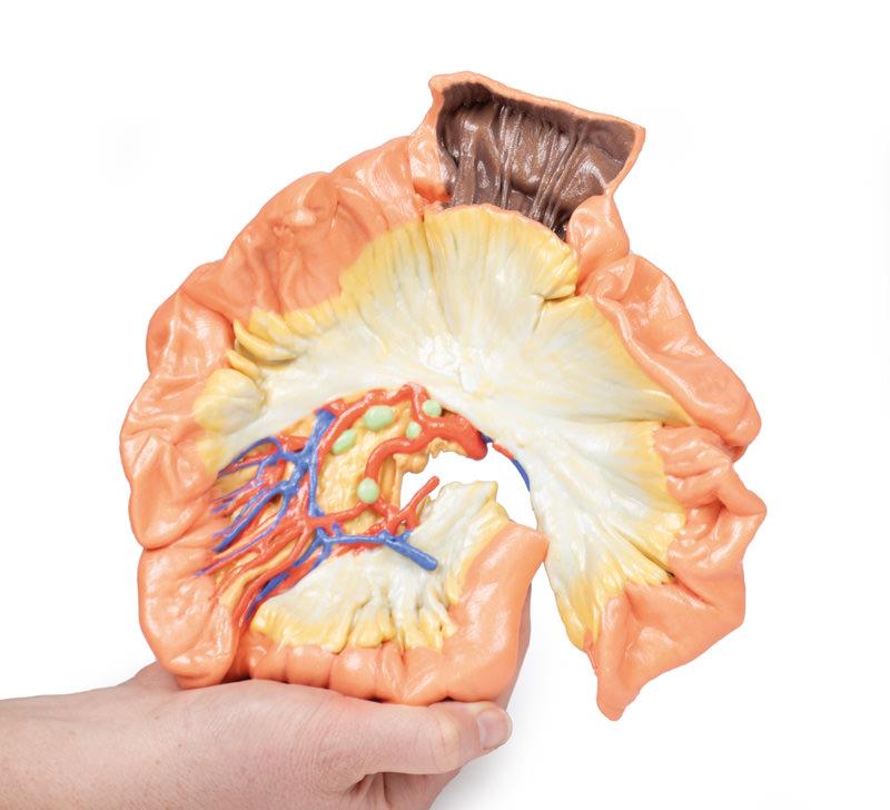 Bowel - Portion of Jejenum - 5