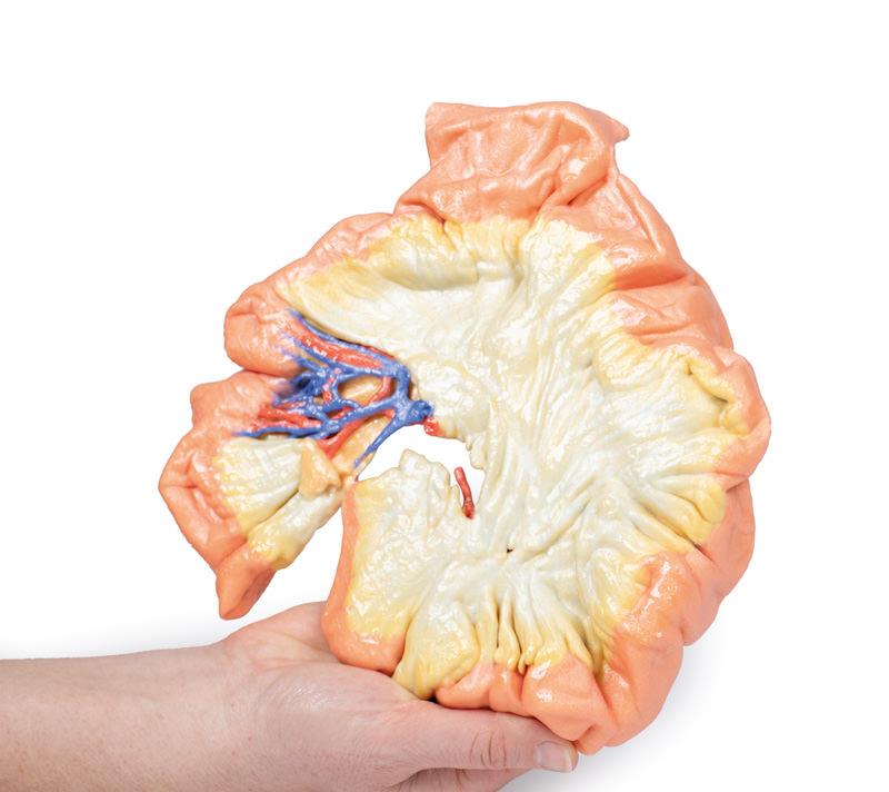 Bowel - Portion of Jejenum - 6