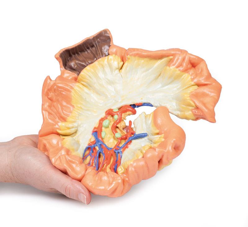 Bowel - Portion of Jejenum - 7