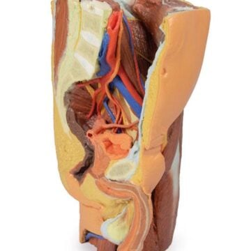 Male left pelvis and proximal thigh