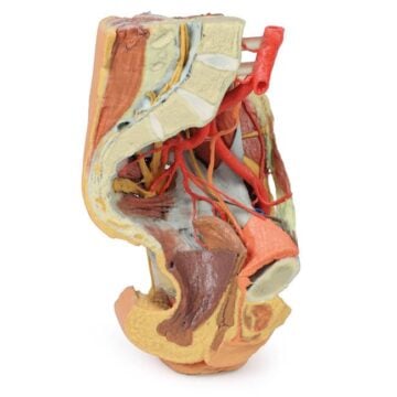 Female left pelvis and proximal thigh