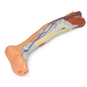 Lower limb superficial dissection