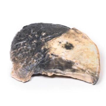 Lobar pneumonia