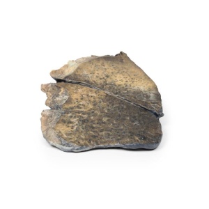 Bronchopneumonia
