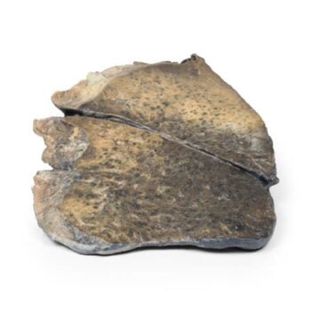 Bronchopneumonia