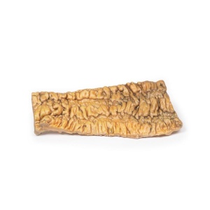 Ulcerative Colitis