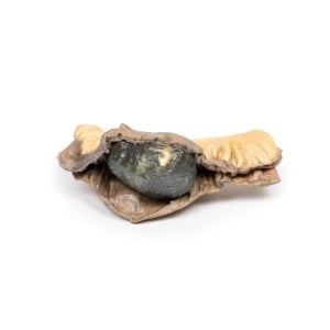 Gall Stone Ileus