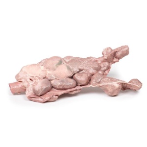 Aorta & para-aortic lymph nodes