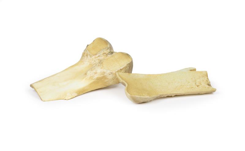 Osteochondroma - 3