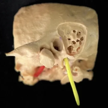 Petrous Bone Simulator