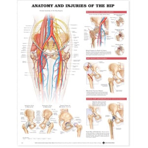 Anatomy and Injuries of the Hip Anatomical Chart – Soft Laminate