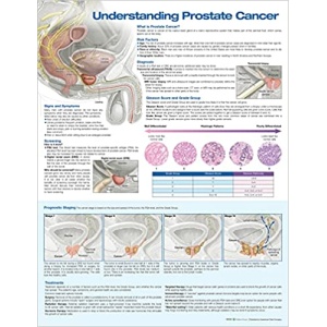 Understanding Prostate Cancer Anatomical Chart – Soft Laminate