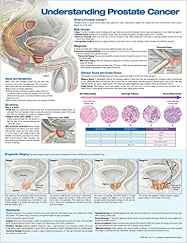 Understanding Prostate Cancer Anatomical Chart - Soft Laminate