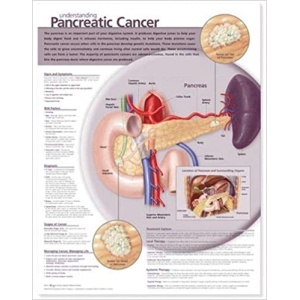 Understanding Pancreatic Cancer Anatomical Chart – Soft Laminate