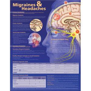 Migraines and Headaches Anatomical Chart – Soft Laminate