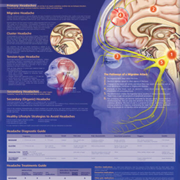Migraines and Headaches Anatomical Chart - Soft Laminate