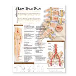 Understanding Low Back Pain Anatomical Chart – Soft Laminate