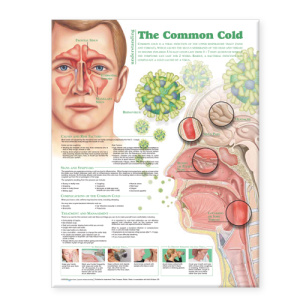 Understanding the Common Cold Anatomical Chart – Soft Laminate