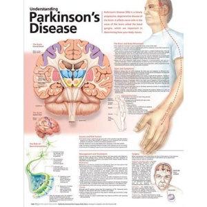 Understanding Parkinson’s Disease Anatomical Chart – Soft Laminate