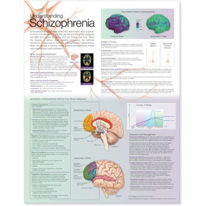 Understanding Schizophrenia Anatomical Chart – Soft Laminate