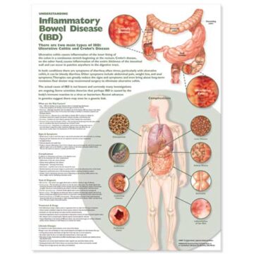 Understanding Inflammatory Bowel Disease (IBD) Anatomical Chart - Soft Laminate