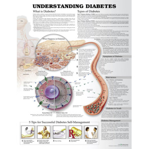 Understanding Diabetes Anatomical Chart – Soft Laminate