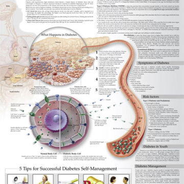 Understanding Diabetes Anatomical Chart - Soft Laminate
