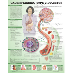 Understanding Type 2 Diabetes Anatomical Chart – Soft Laminate