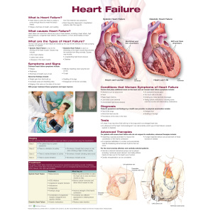 Heart Failure – Soft Laminate