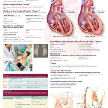 Heart Failure - Soft Laminate