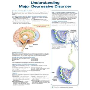 Understanding Major Depressive Disorder – Soft Laminate