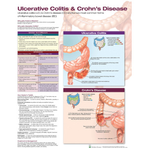 Ulcerative Colitis & Crohn’s Disease – Soft Laminate