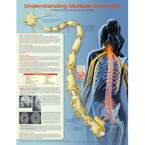 Understanding Multiple Sclerosis – Soft Laminate