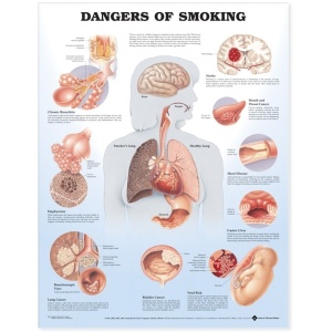 Dangers of Smoking Anatomical Chart – Soft Laminate