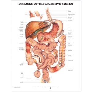 Diseases of the Digestive System Anatomical Chart – Soft Laminate