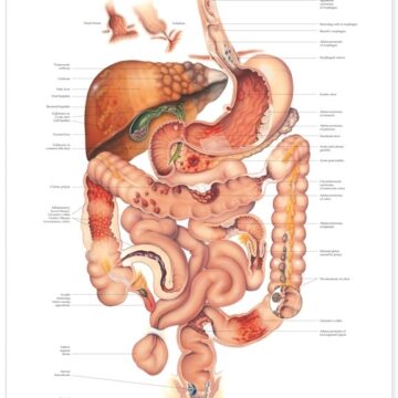 Diseases of the Digestive System Anatomical Chart - Soft Laminate