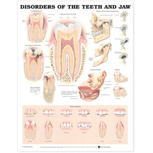Disorders of the Teeth and Jaw Anatomical Chart – Soft Laminate