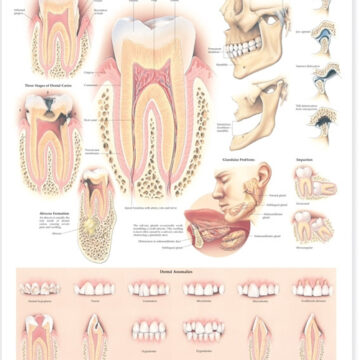Disorders of the Teeth and Jaw Anatomical Chart - Soft Laminate