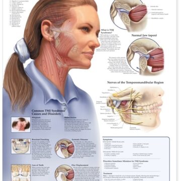 Temporomandibular Joint (TMJ) Anatomical Chart - Soft Laminate