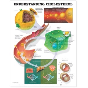 Understanding Cholesterol Anatomical Chart – Soft Laminate