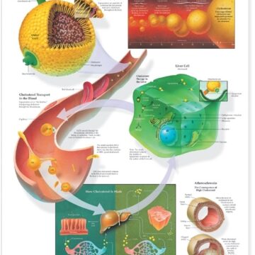 Understanding Cholesterol Anatomical Chart - Soft Laminate