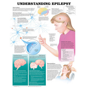 Understanding Epilepsy Anatomical Chart – Soft Laminate