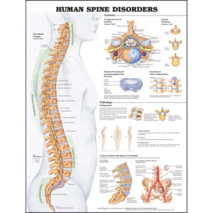 Human Spine Disorders Anatomical Chart – Soft Laminate